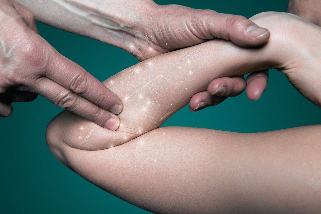 Ginnastica antalgica: trattamento presso Fondazione CRIDA