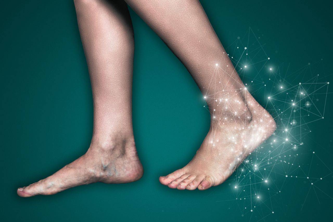 Trattamento neurologico geriatrico